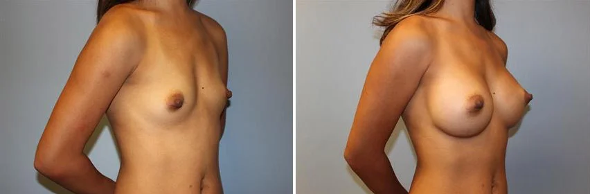 "Juliet" • 124 lbs • Silicone • 405cc