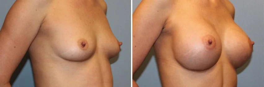 "Danielle" • 117 lbs • Silicone • 457cc