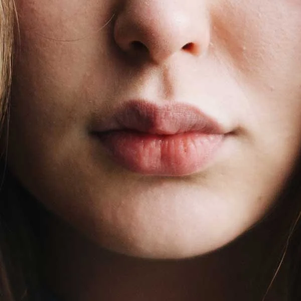 Juvederm-Raleigh0.jpg