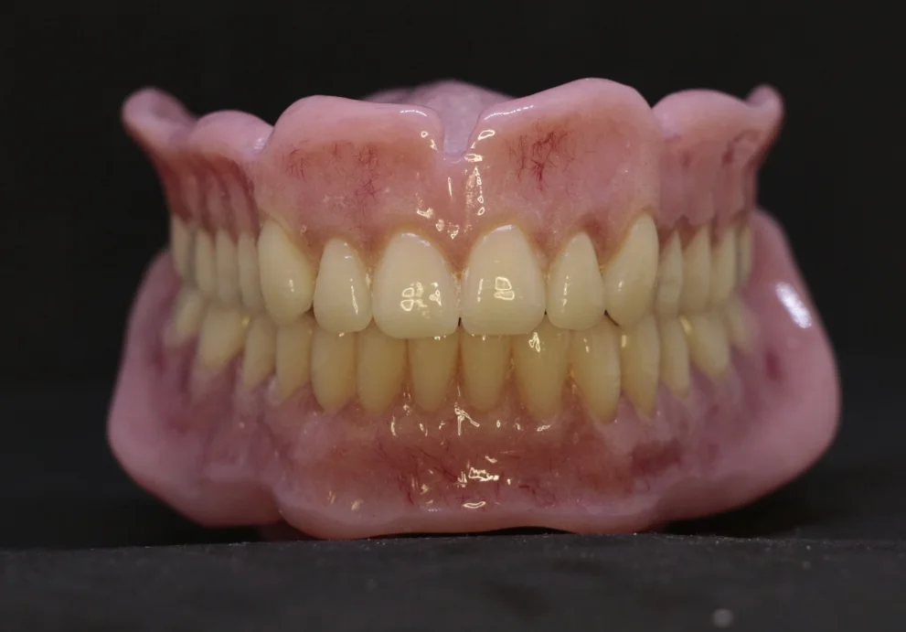 Gallery — Signature Denture Studio