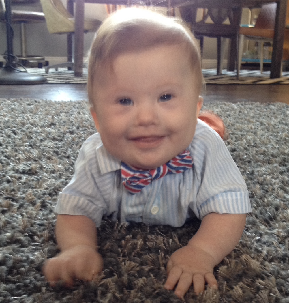 340: Throwback: What Do You Wish You Knew When You Got Your Child's Down Syndrome Diagnosis? (Ep. 138