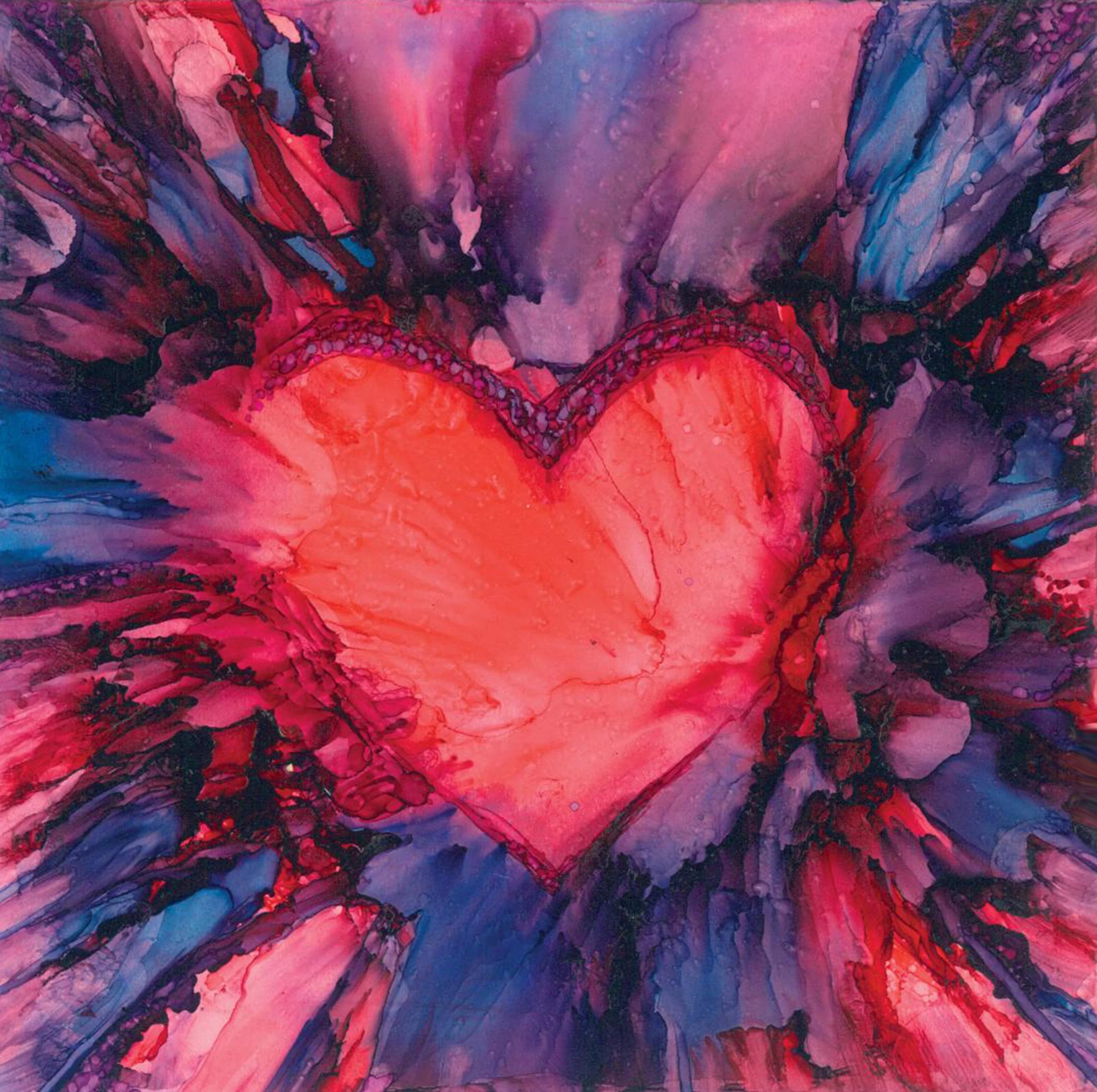 Open Heart