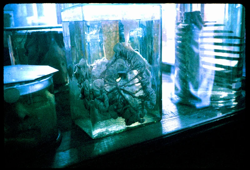 9Jars.jpg