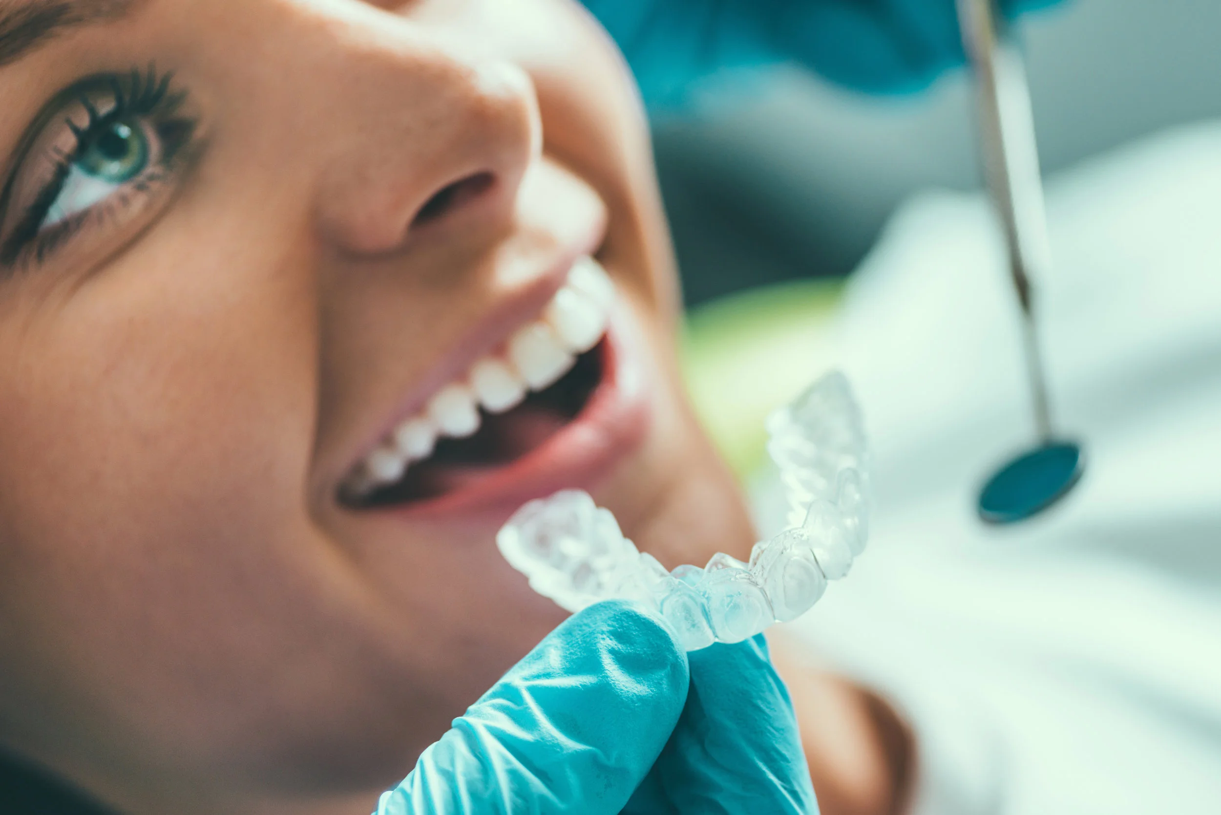 tooth-whitening-procedure-P7NFRZA.jpg
