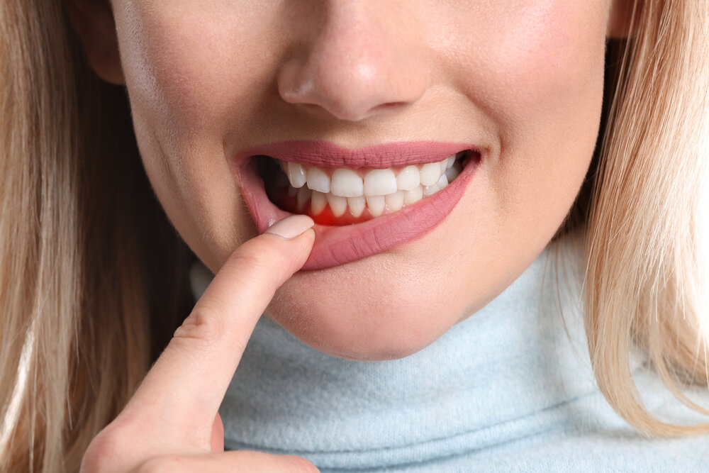 Periodontal Treatment In Mesa, Az