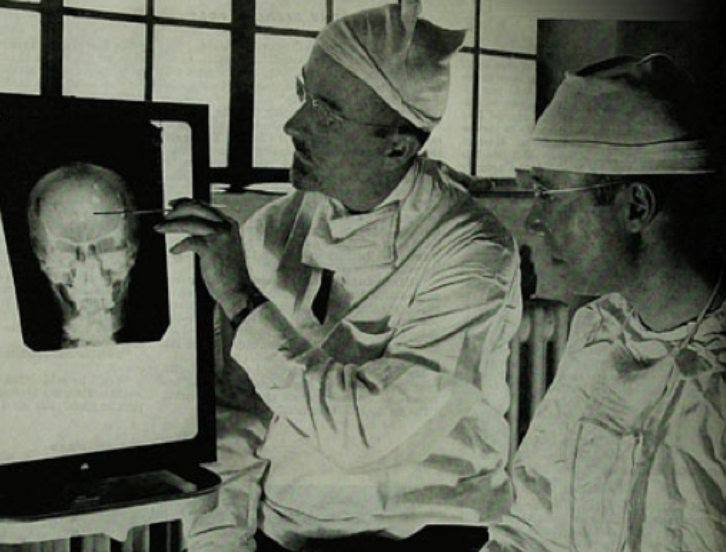 Dr. Walter Freeman and Dr. James Watts examine an x-ray before a psychosurgical procedure.