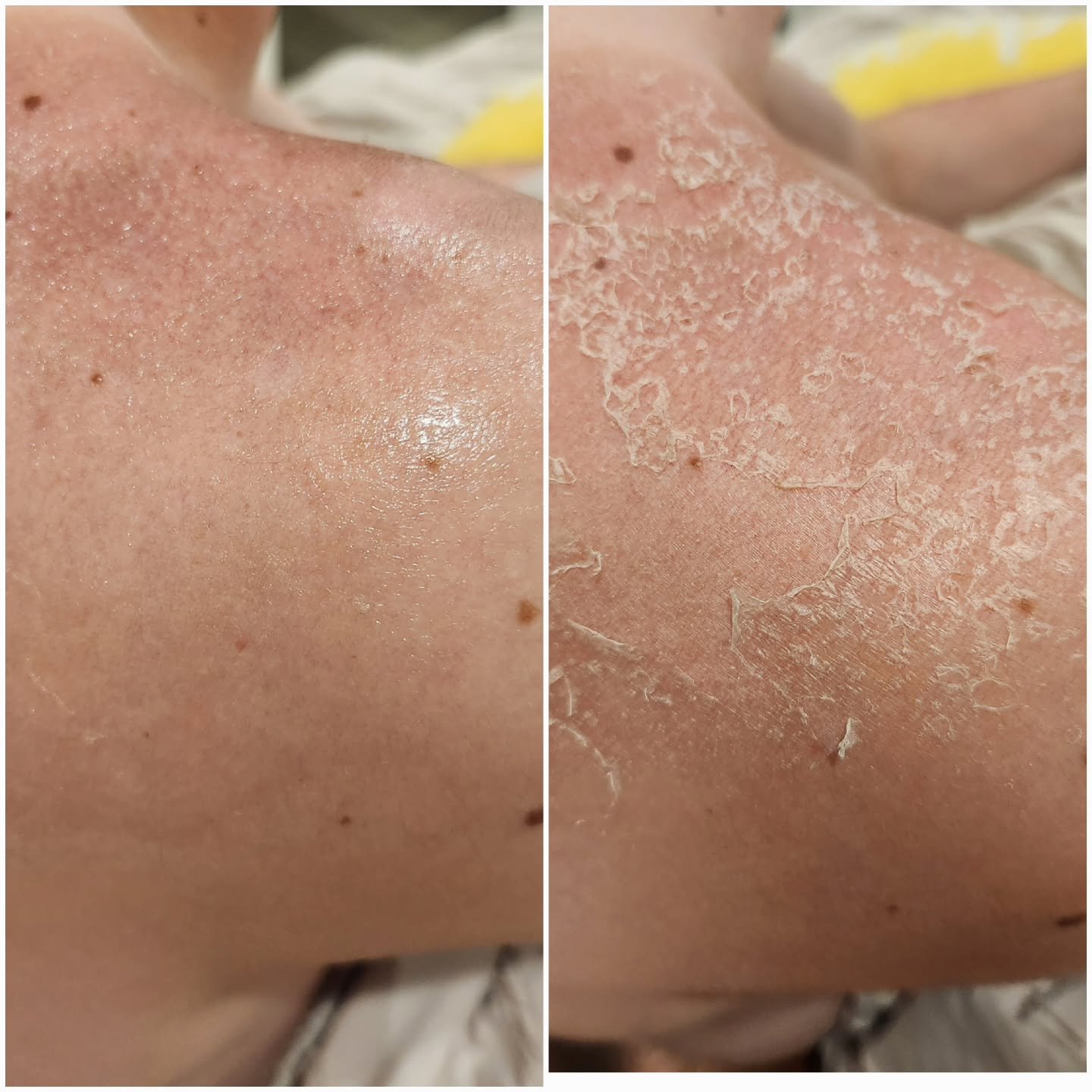 Before/after ➡️ Skin Glow Up ✨️ using That&rsquo;s That Magic Skin Softener ✨Dry skin? Not with this magic. This glow is a lifestyle. That&rsquo;s That Magic isn&rsquo;t just a name&mdash;it&rsquo;s a whole transformation. (Link in bio)