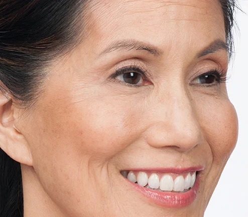 Susan After
