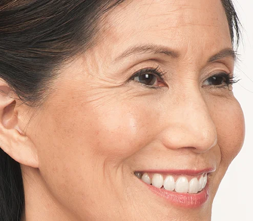 Susan Before