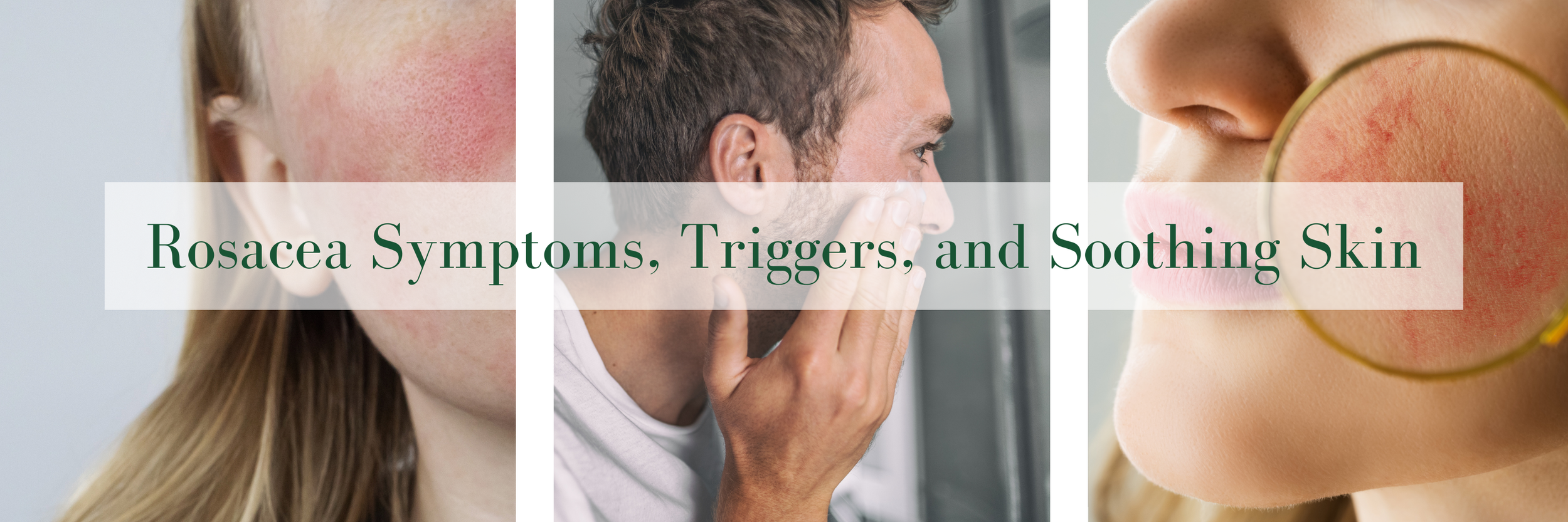 Rosacea Symptoms, Triggers, and Soothing Your Skin