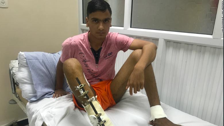 Maddah, 18, is being treated for a bullet wound to the leg.