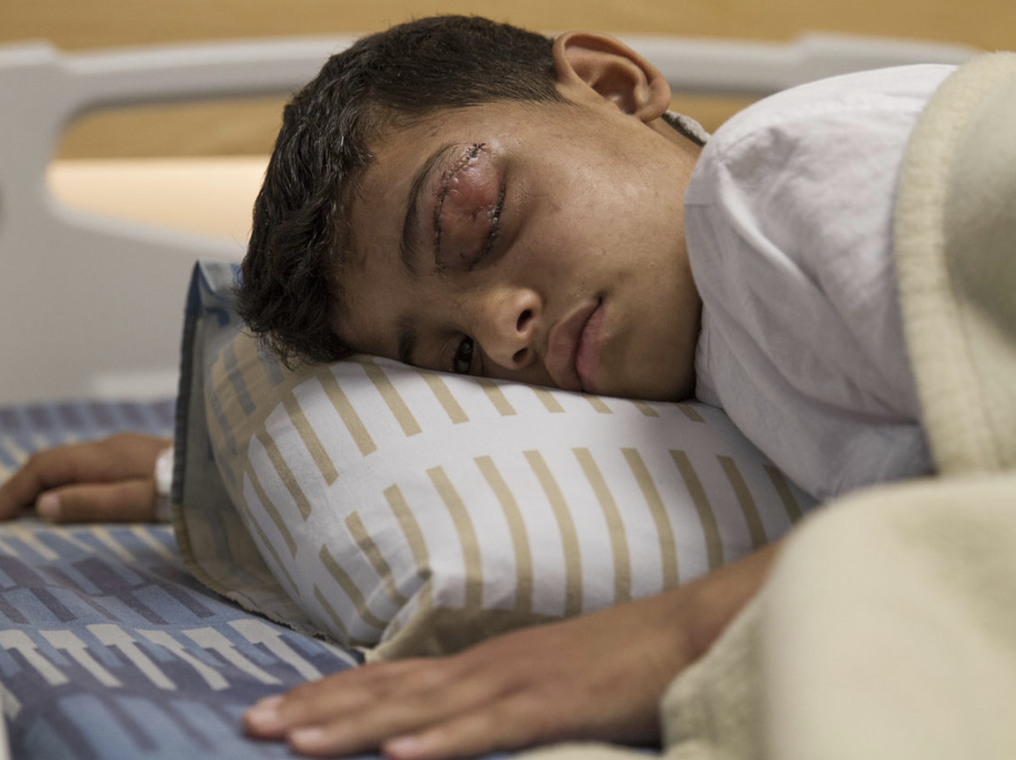 Mahmoud resting during our visit today. His family are worried about his long term recovery, particularly the brain damage he has suffered, and prospects for his rehabilitation.