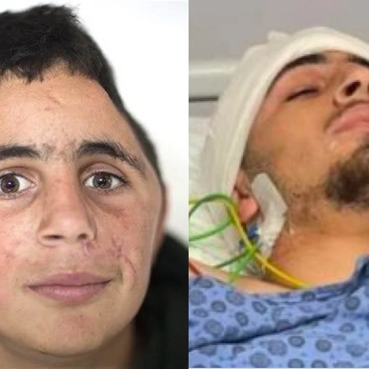 Palestinian youth survived Israeli bullet in 2017, survives assassination attempt in 2022