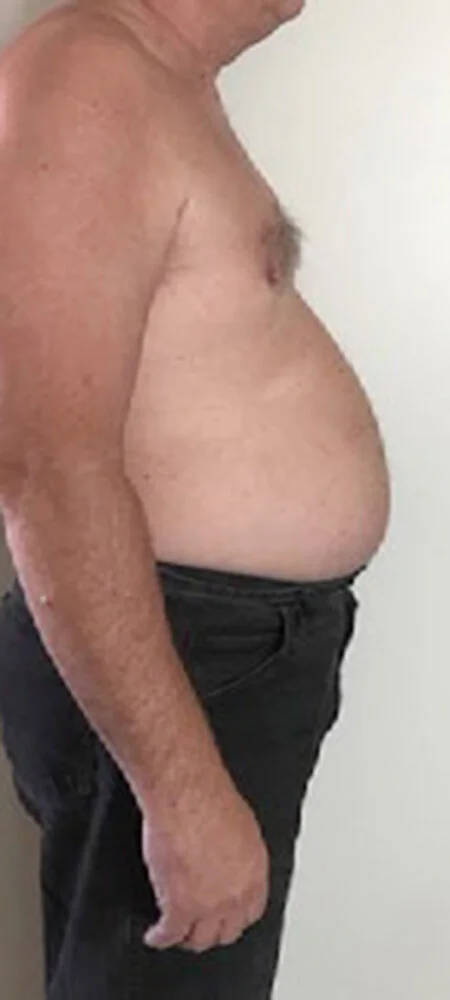 Slenderiiz-Weight-Loss-Before-and-After-3.0.jpg
