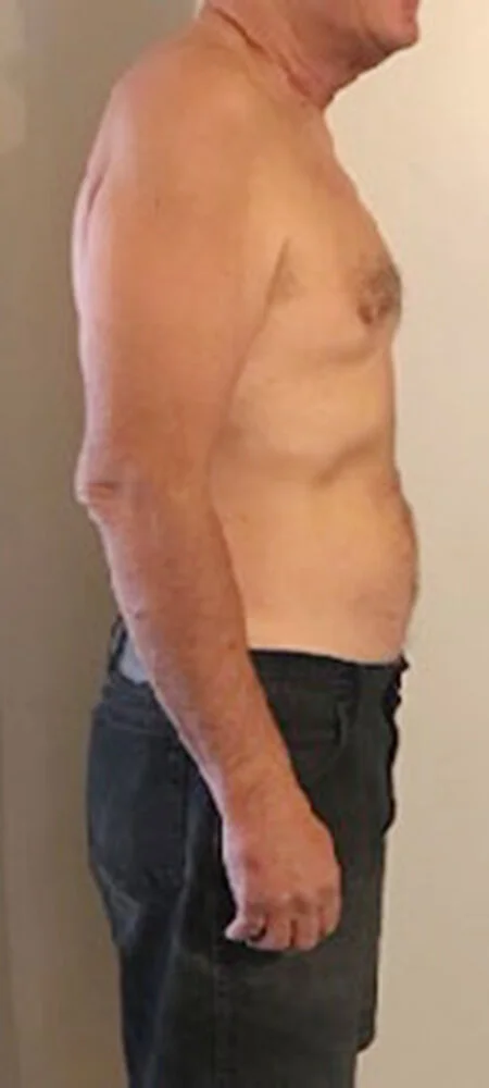 Slenderiiz-Weight-Loss-Before-and-After-3.5.jpg