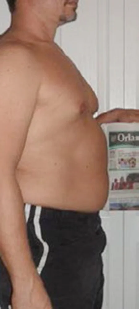 Slenderiiz-Weight-Loss-Before-and-After-4.0.jpg