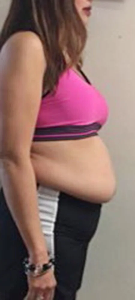 Slenderiiz-Weight-Loss-Before-and-After-5.0.jpg