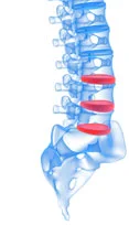 spine.jpg
