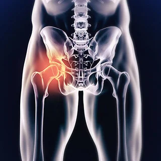 CS-Hip-Femoroacetabular-Arthroscopy.jpg