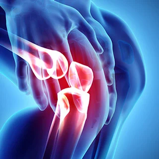 CS-Knee-Osteoarthritis.jpg