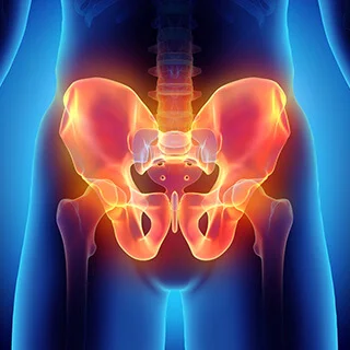 CS-Pelvic-Ring-Fracture.jpg