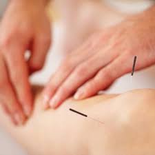 knee needles.jpg