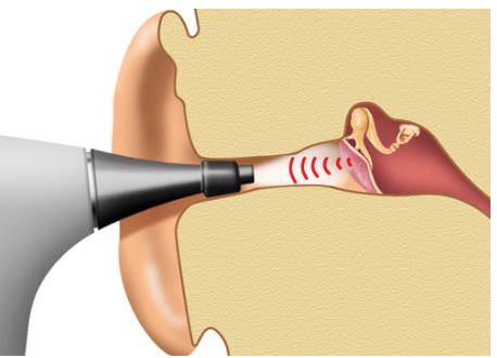 otonexus.png