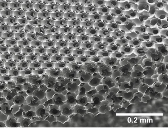 Healionics’ Sphere Templated Angiogenic Regeneration (STAR) biomaterial