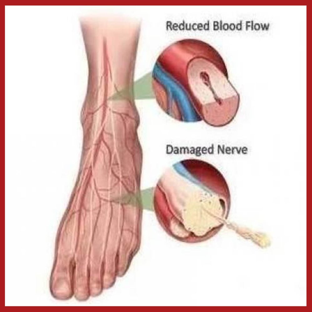 Diabetic Feet Treatment Santa Maria Podiatry Clinic