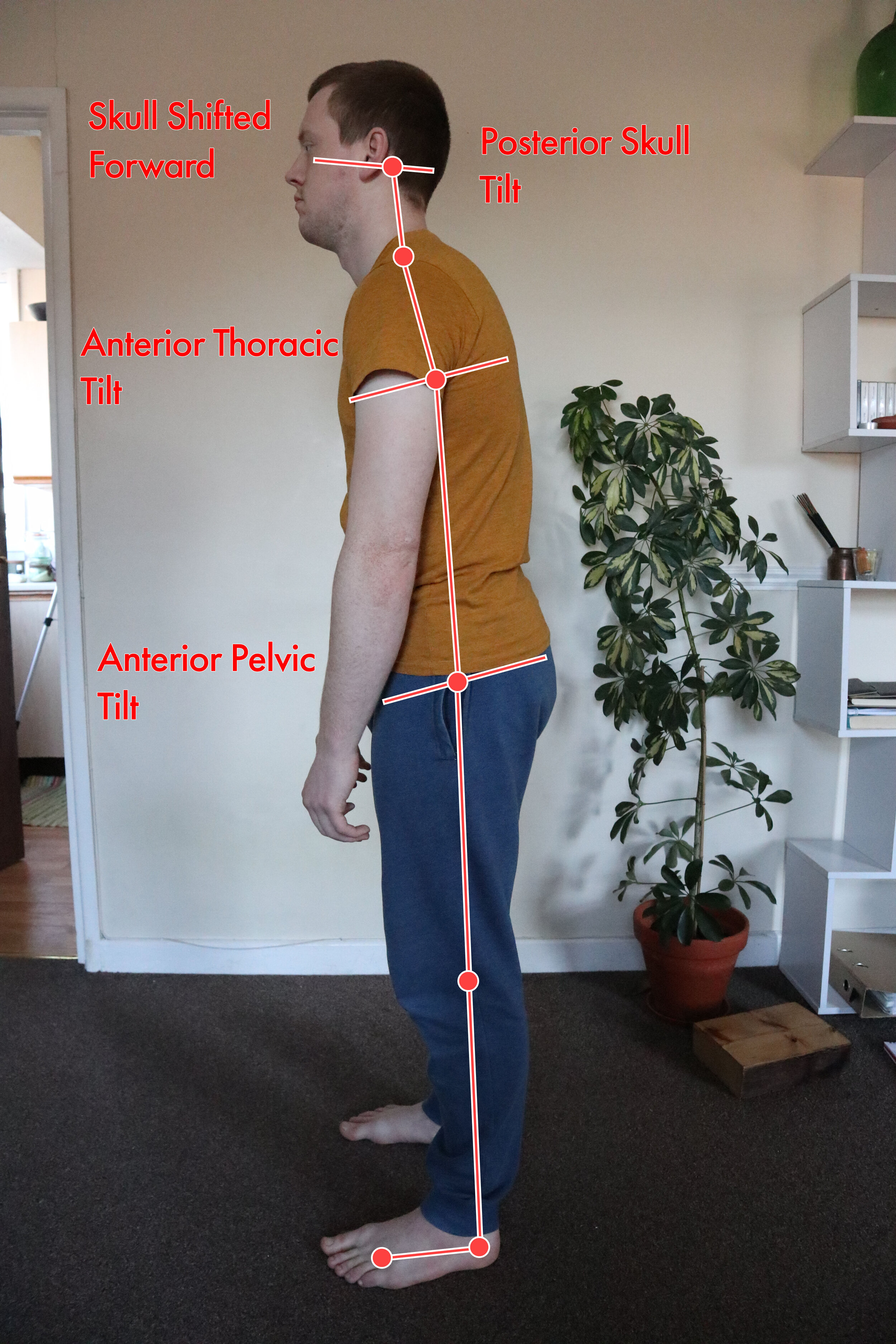 bad posture Movementum.jpg