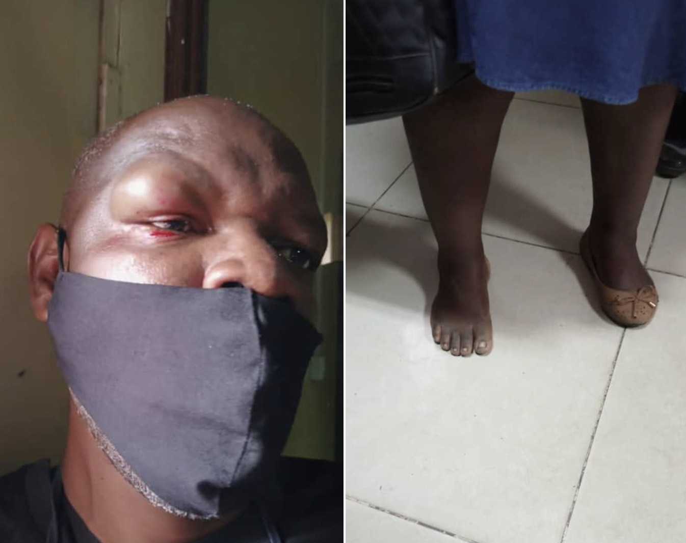 PF Supporters Attack Two Journalists