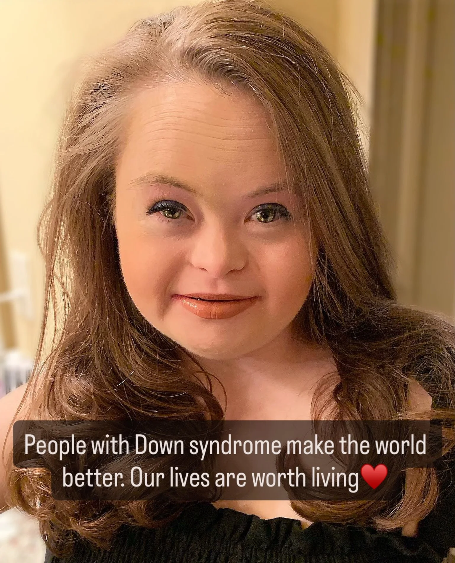Grace&rsquo;s life is worth living just like your life is worth living. ❤️