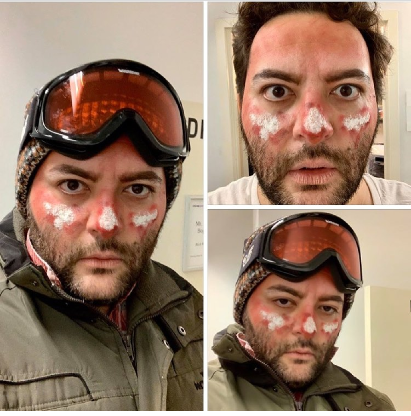 Frostbite makeup for Chicago Opera Theater's "Everest" 2018
