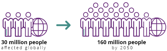 Alzheimers_demo_global.gif