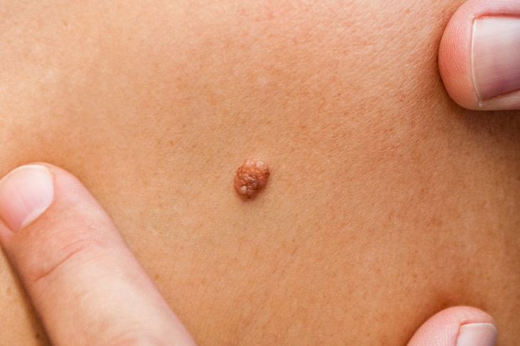 skin exam.jpeg