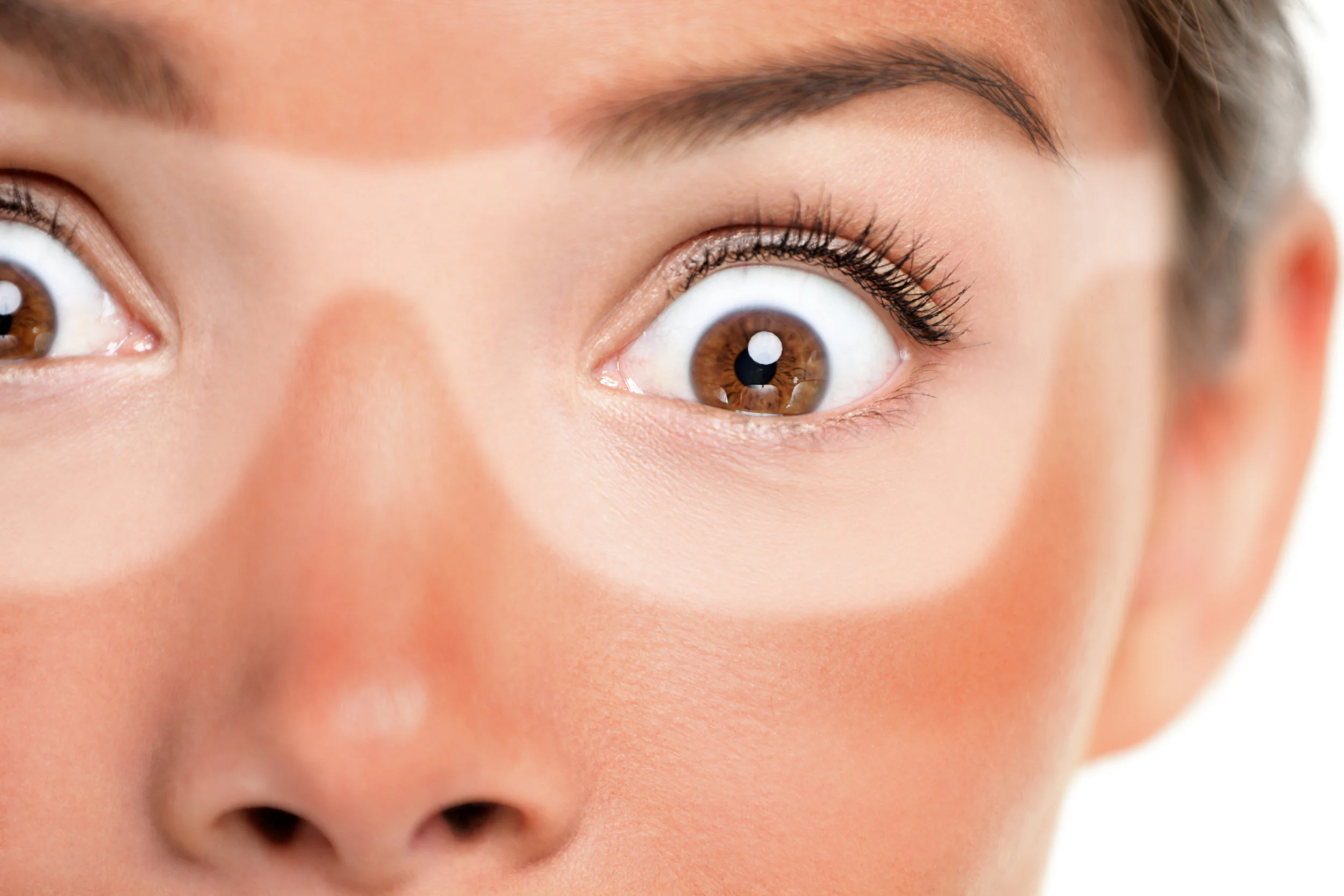 bigstock-Sunburn-tan-lines-of-sunglasse-221187538.jpg