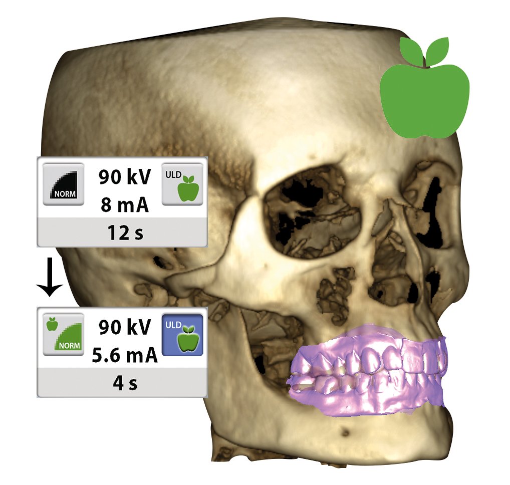 Planmeca Ultra Low Dose
