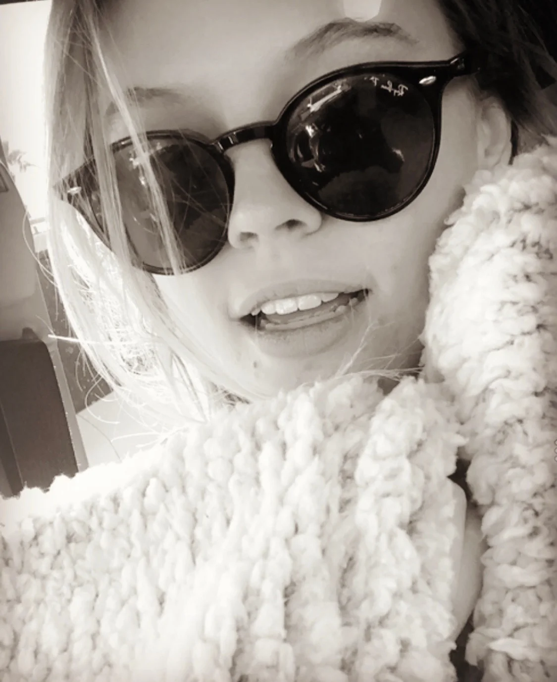 How I Stay Confident Through Perioral Dermatitis