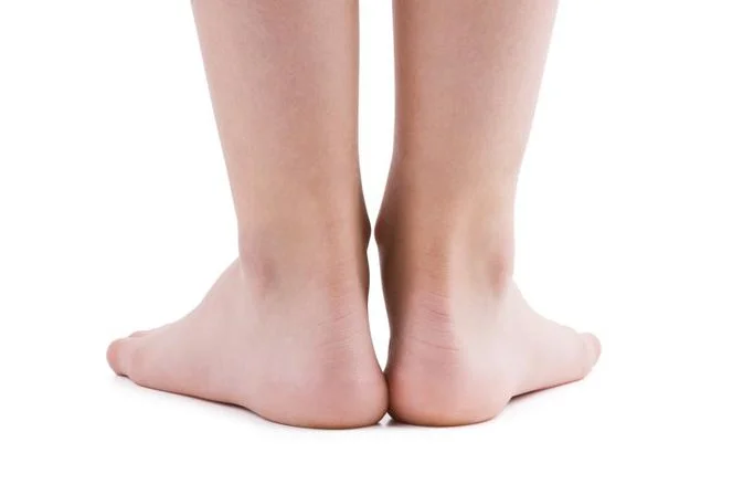 Achilles Tendonitis