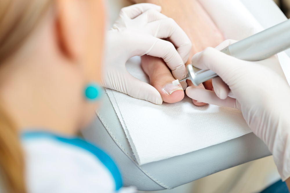 Podiatry Nail Care Treatment Toe Pain
