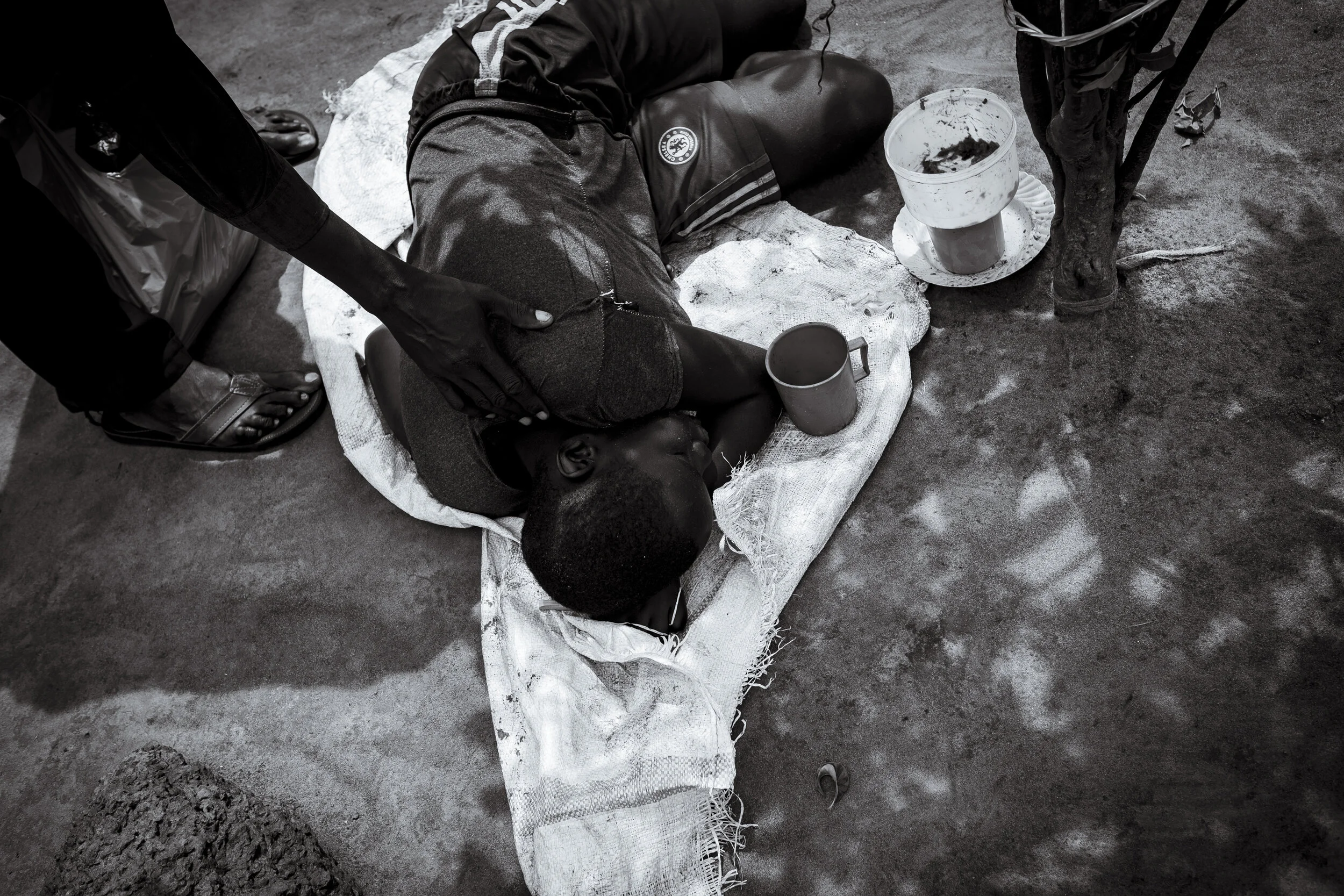  Anai Agali, Lira District. George Abaa leans in to wake his eleven year old daughter Naomi Ecuto. She will spend most of the day sitting or lying on a sack in the limited shade of a small shrub in the front yard of the family home. Her spine is curv