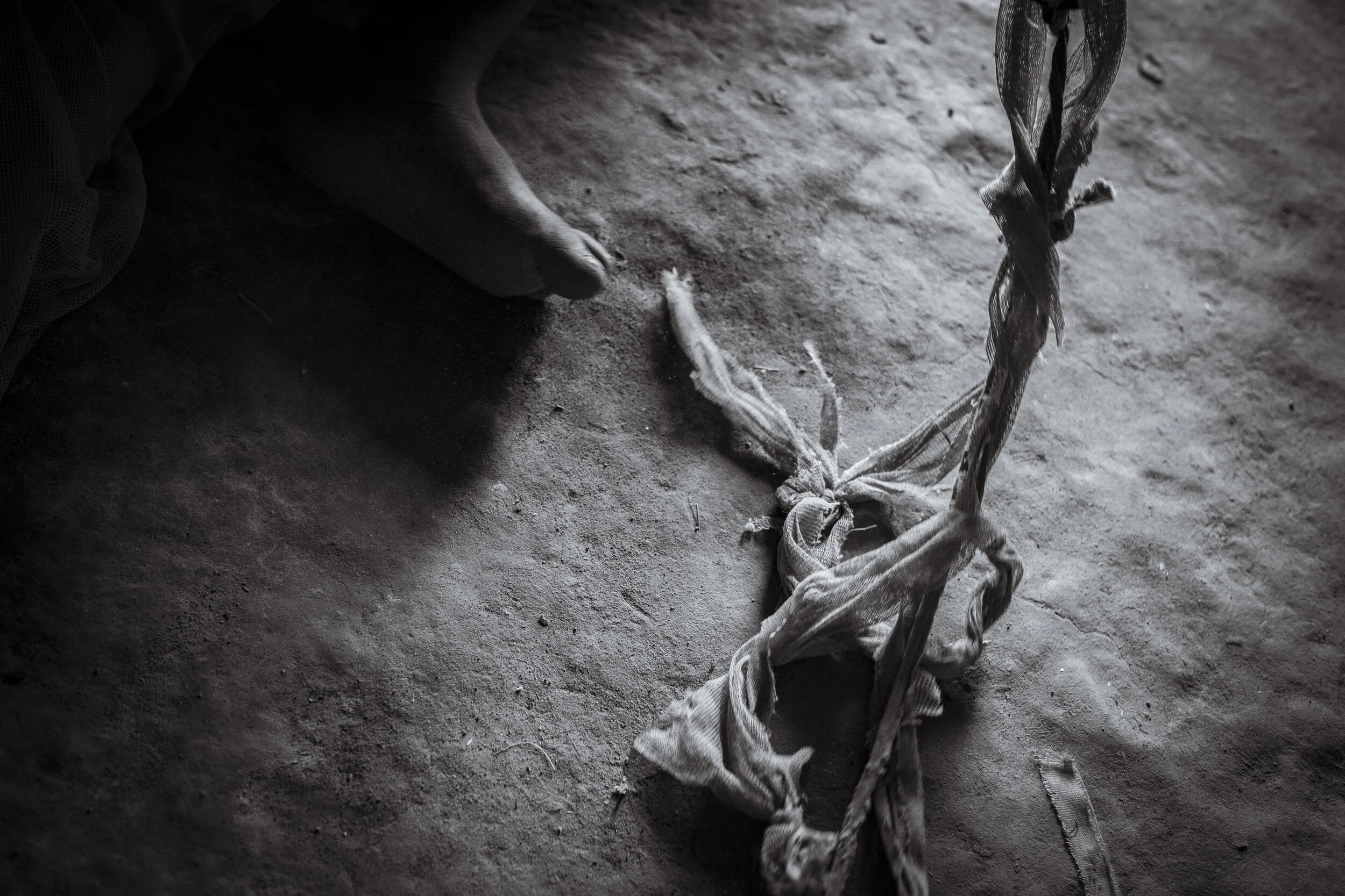  Obur, Soroti District. Thirteen year old Silus Odii sits with the rope that is used to tether him to a crate inside the single room family home in Obur, eastern Uganda.  