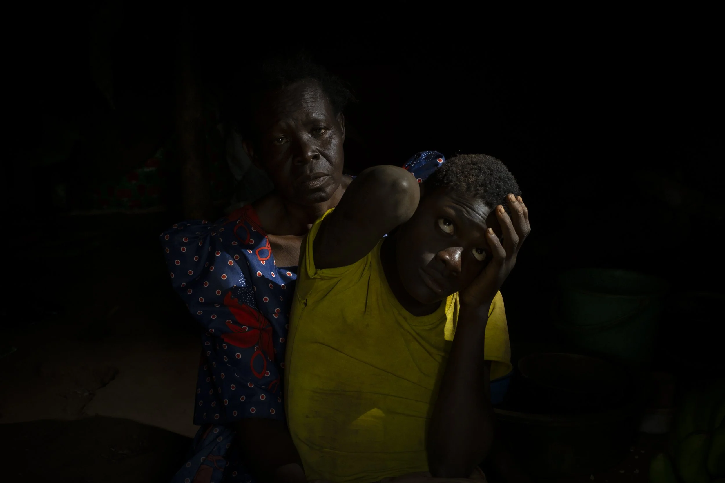  Nabwiguru, Kamuli District. Lovinsa Namwebya and son Perez Mbwase. Namwe tried for years to have her son’s condition diagnosed. Unable to deal with his aggression and hyperactivity, his parents tied him to a tree for 11 years. He was fed and toilete