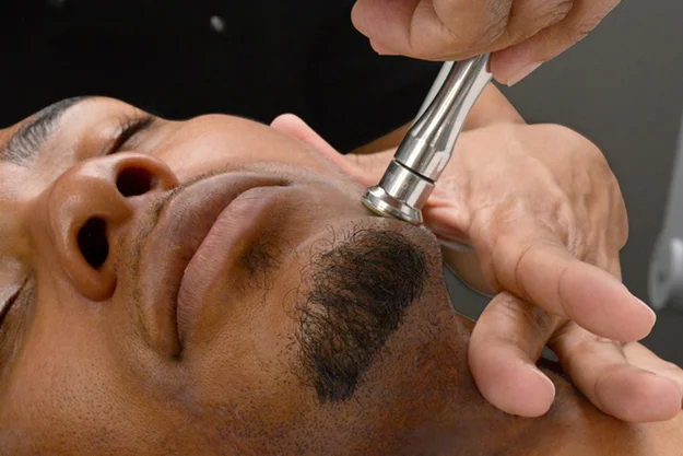 Microdermabrasion Series