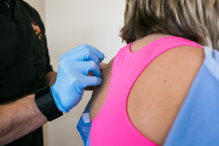 ACUPUNCTURE AND DRY NEEDLING