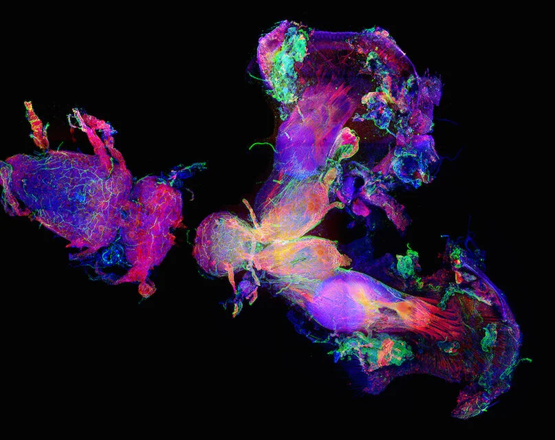 The central nervous system from a horned dung beetle (Onthophagus sagittarius). This image was taken from a National Science Foundation-supported research project on the evolution of novel and complex traits.