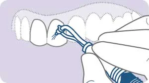 Procedure-1.jpg