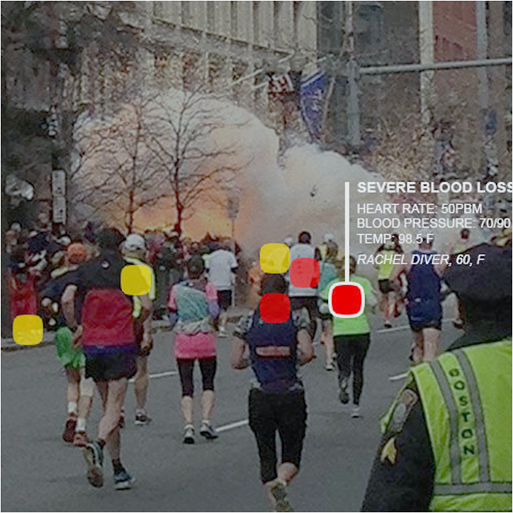 1000_ems.png