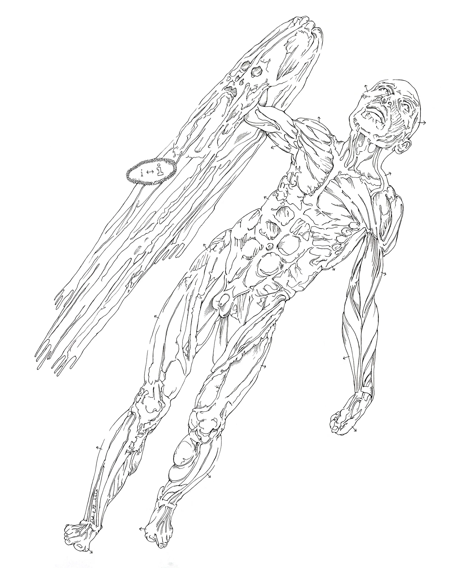 i <> I (Organ Removal)