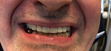 GCS_Dental-Lab-RealSmile-0001.jpg